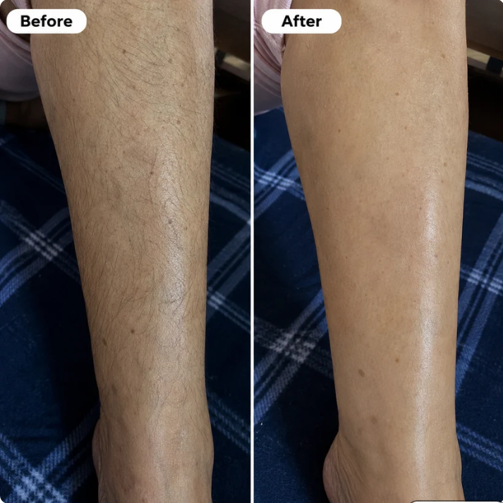 Virex Hair Removal Cream